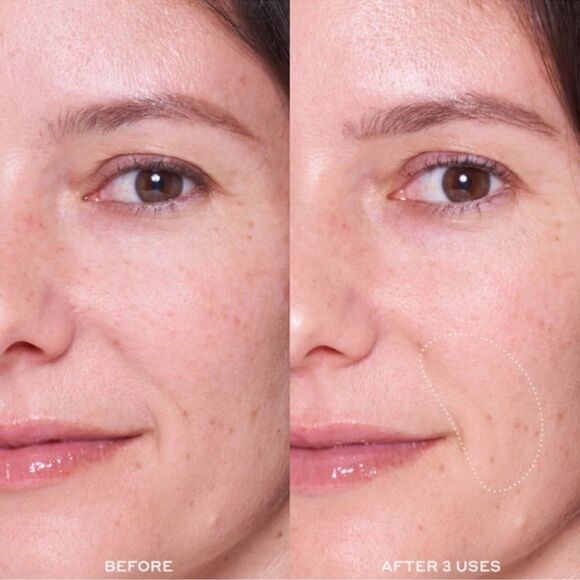 Ole Henriksen DEWTOPIA 25% ACID FLASH FACIAL MASK NWT - Picture 7 of 8